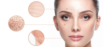 Tarifs soin visage Phyt's dans votre institut de beauté à Sainte-Foy-la-Grande Tarifs soin visage Phyt's dans votre institut de beauté à Sainte-Foy-la-Grande